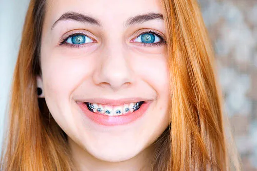 Clínica de Ortodoncia José Selfa niña monstrando brackets