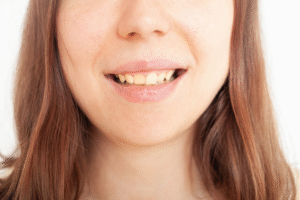 Cómo saber si necesitas ortodoncia